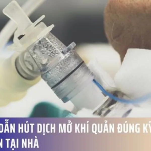 Hướng dẫn hút dịch mở khí quản đúng kỹ thuật, an toàn tại nhà