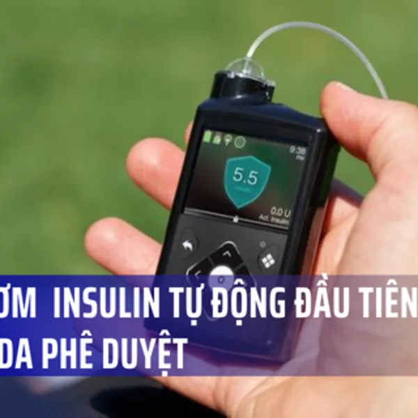 FDA cấp phép cho máy bơm insulin tự động cho bệnh nhân đái tháo đường tuýp 1