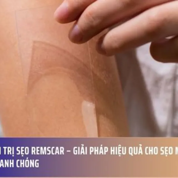 Miếng dán trị sẹo Remscar – Giải pháp hiệu quả cho sẹo mụn, mềm mịn da nhanh chóng