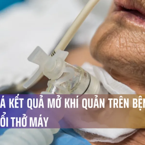 ĐÁNH GIÁ KẾT QUẢ MỞ KHÍ QUẢN TRÊN BỆNH NHÂN VIÊM PHỔI THỞ MÁY