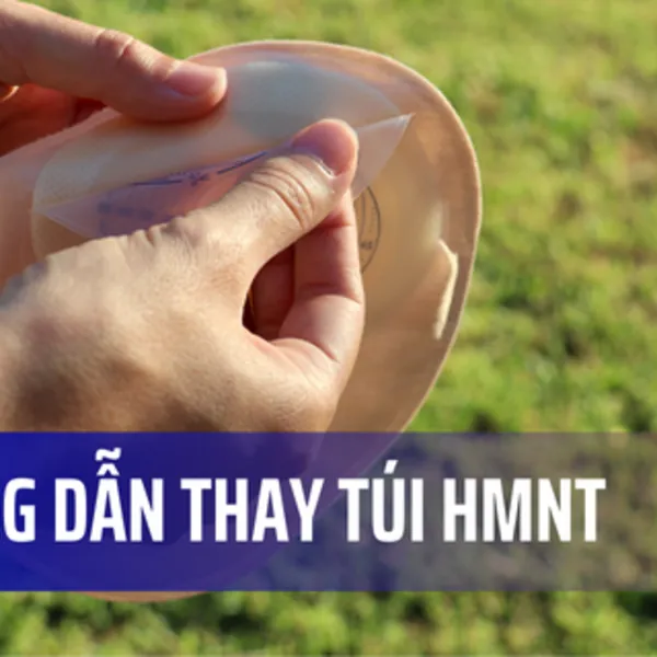 Hướng dẫn thay túi hậu môn nhân tạo