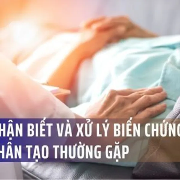 Cách nhận biết và xử lý biến chứng hậu môn nhân tạo thường gặp