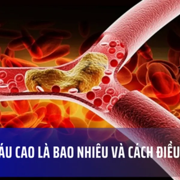 Mỡ máu cao là bao nhiêu và cách điều chỉnh