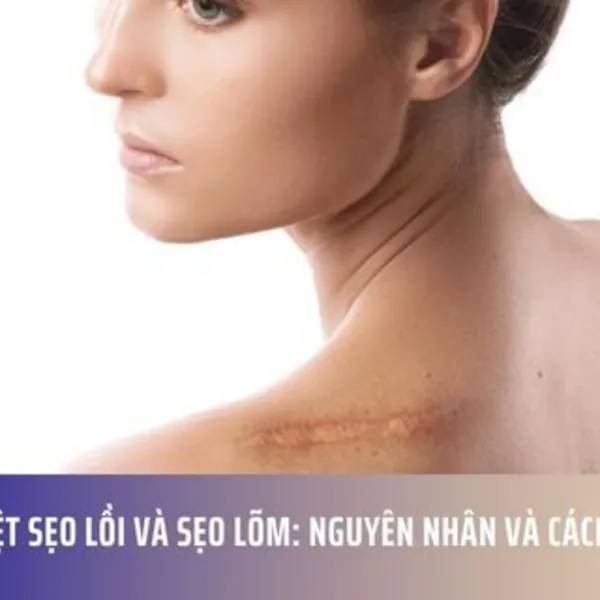 Phân Biệt Sẹo Lồi và Sẹo Lõm: Nguyên Nhân và Cách Điều Trị