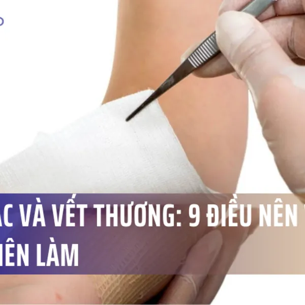 Băng gạc và vết thương: 9 điều nên và không nên làm