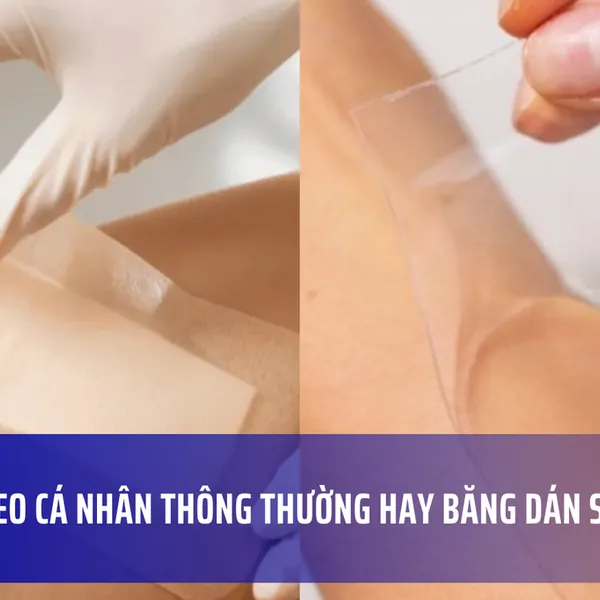 Nên sử dụng băng keo cá nhân thông thường hay băng dán silicone?