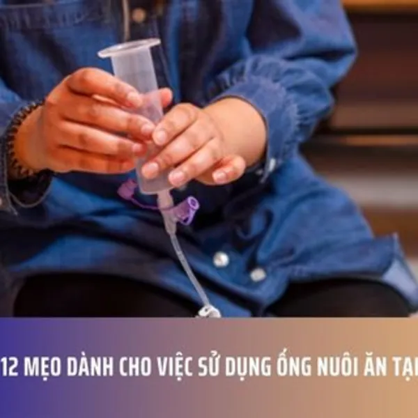 12 Mẹo Dành Cho Việc Sử Dụng Ống Nuôi Ăn Tại Nhà
