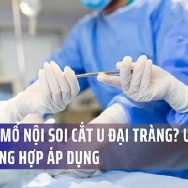 Có Nên Mổ Nội Soi Cắt U Đại Tràng? Ưu Điểm & Trường Hợp Áp Dụng