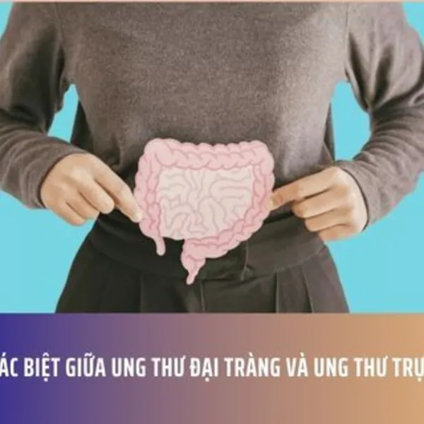 Sự khác biệt giữa ung thư đại tràng và ung thư trực tràng