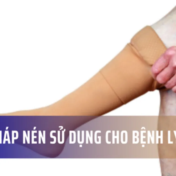 Liệu pháp nén ép tĩnh mạch được sử dụng cho những bệnh lý nào?