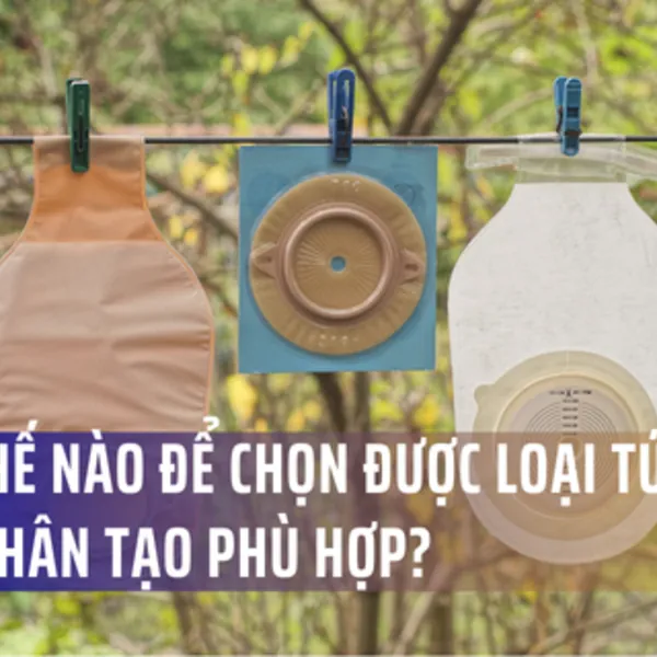Lựa chọn túi hậu môn nhân tạo thích hợp: Túi một mảnh hay hai mảnh?