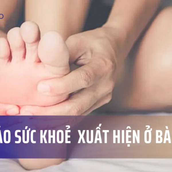 Những cảnh báo về sức khỏe xuất hiện ở bàn chân