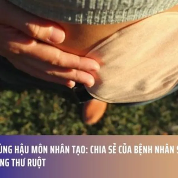 Sống cùng hậu môn nhân tạo: Chia sẻ của bệnh nhân sau chẩn đoán ung thư ruột