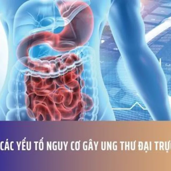 Hiểu Rõ Các Yếu Tố Nguy Cơ Gây Ung Thư Đại Trực Tràng