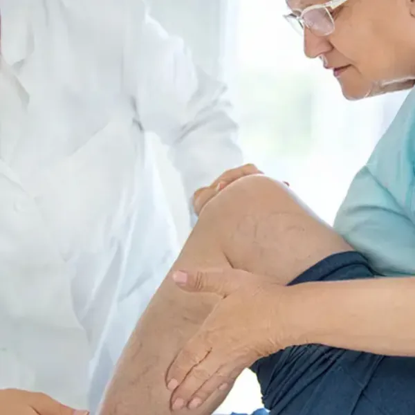 Sử dụng vớ nén và tất nén để phòng ngừa và điều trị suy giãn tĩnh mạch