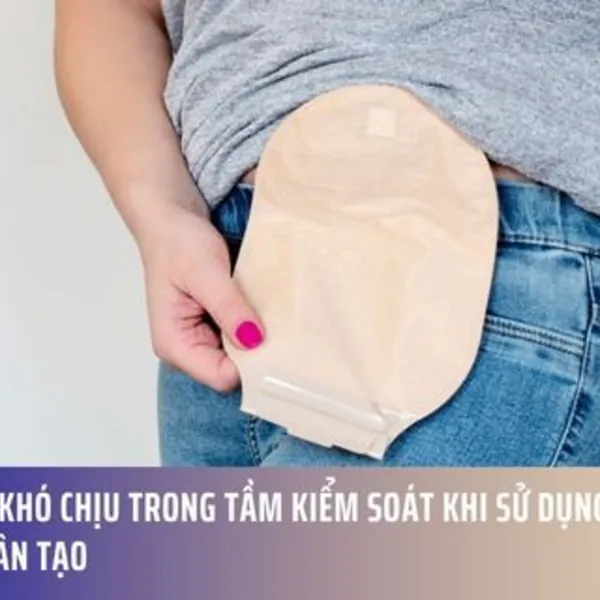 Giữ Mùi Khó Chịu Trong Tầm Kiểm Soát Khi Sử Dụng Túi Hậu Môn Nhân Tạo