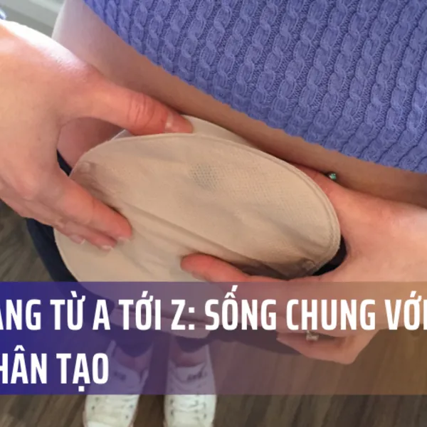 Cẩm nang từ A tới Z: Sống chung với hậu môn nhân tạo