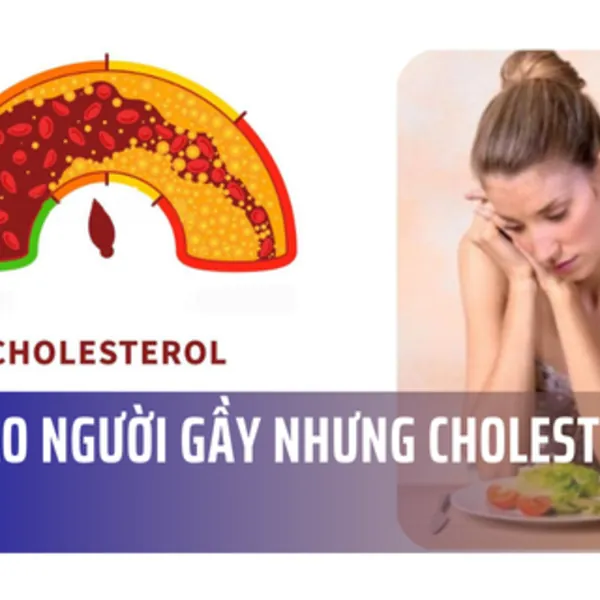 Tại sao người gầy nhưng cholesterol cao?