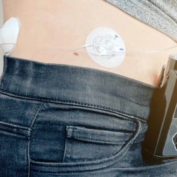 Máy theo dõi đường huyết liên tục hoạt động như thế nào?