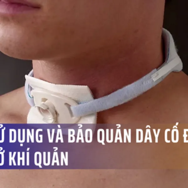 Cách sử dụng và chăm sóc dây đai cố định mở khí quản