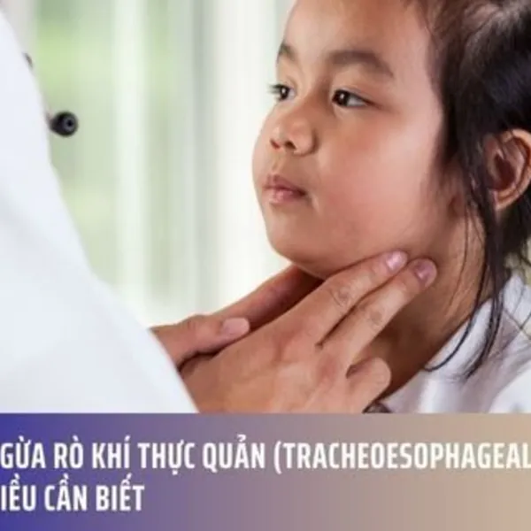 Phòng ngừa rò khí thực quản (tracheoesophageal fistula): Những điều cần biết