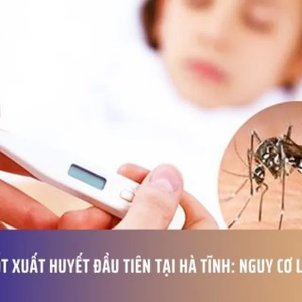 Ổ Dịch Sốt Xuất Huyết Đầu Tiên Tại Hà Tĩnh: Nguy Cơ Lan Rộng