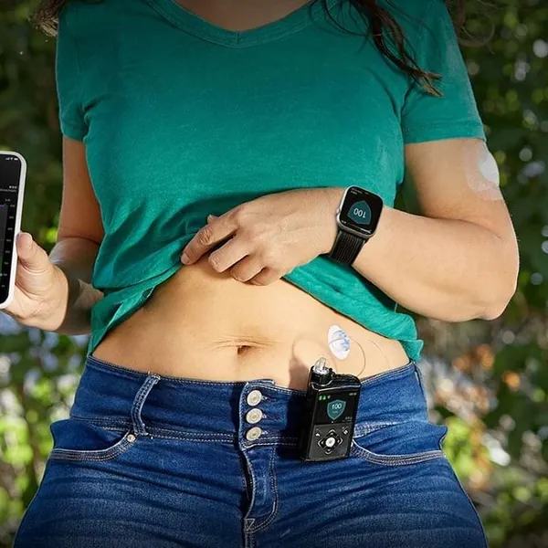 Máy bơm insulin tự động là gì? Bạn đã biết chưa?
