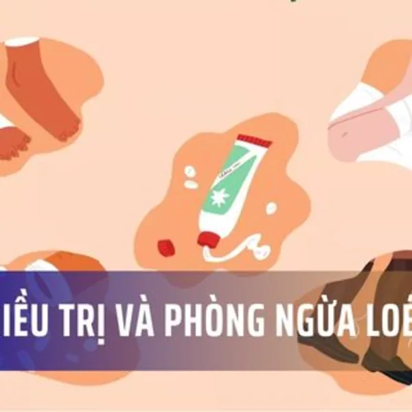 Cách điều trị và phòng ngừa loét da