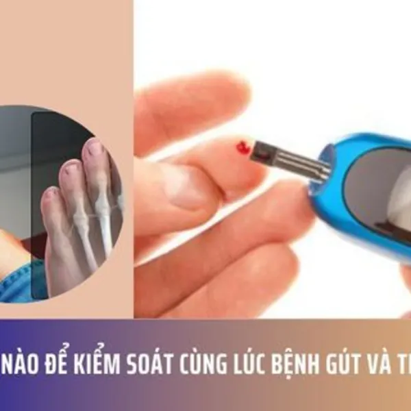 Làm Thế Nào Để Kiểm Soát Cùng Lúc Bệnh Gút và Tiểu Đường