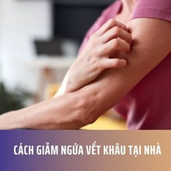 Cách Giảm Ngứa Vết Khâu tại Nhà
