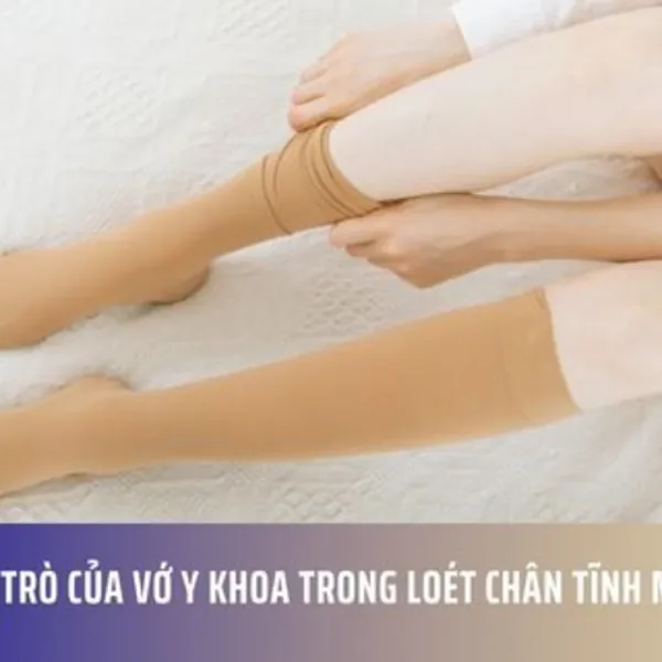Vai trò của vớ y khoa trong loét chân tĩnh mạch