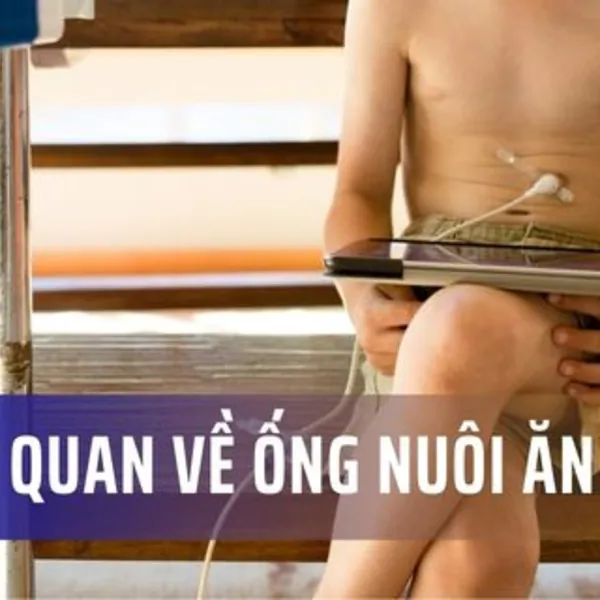 Tổng quan về ống nuôi ăn