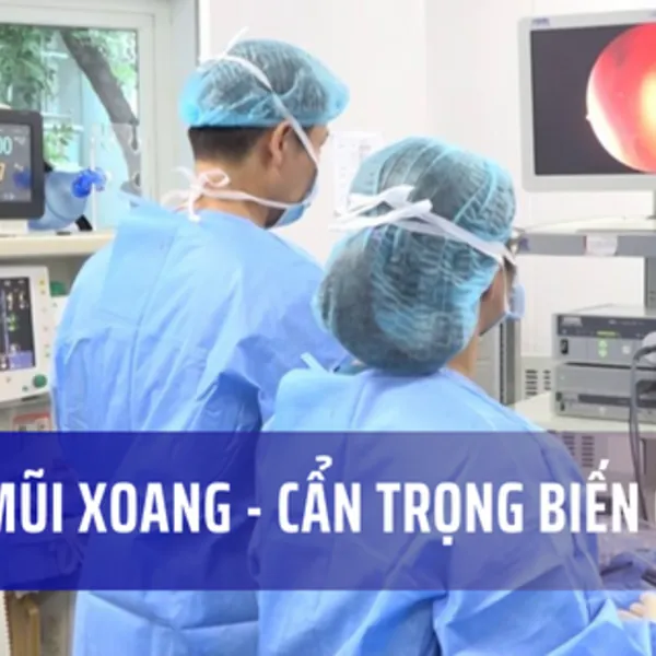 Viêm mũi xoang vào mùa, cẩn trọng nguy cơ biến chứng