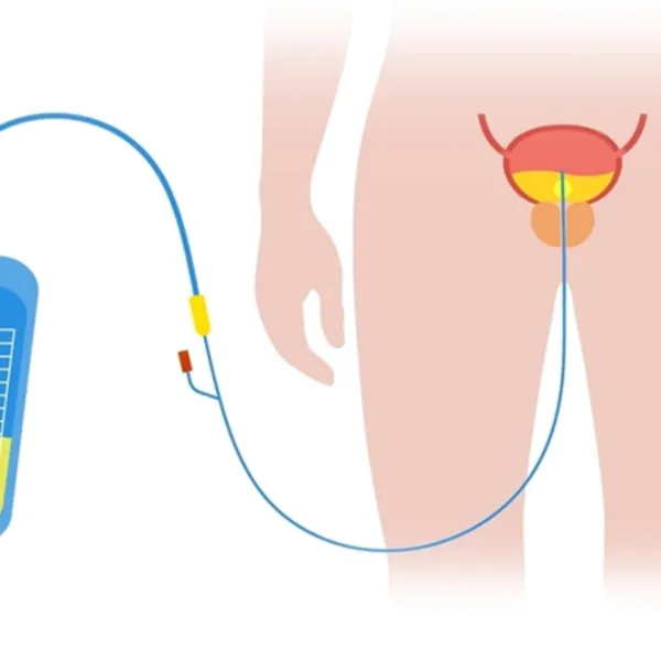 Tự đặt ống thông tiểu cho nam giới