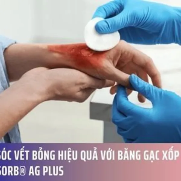 Chăm Sóc Vết Bỏng Hiệu Quả với Băng Gạc Xốp Tẩm Bạc Therasorb® Ag Plus