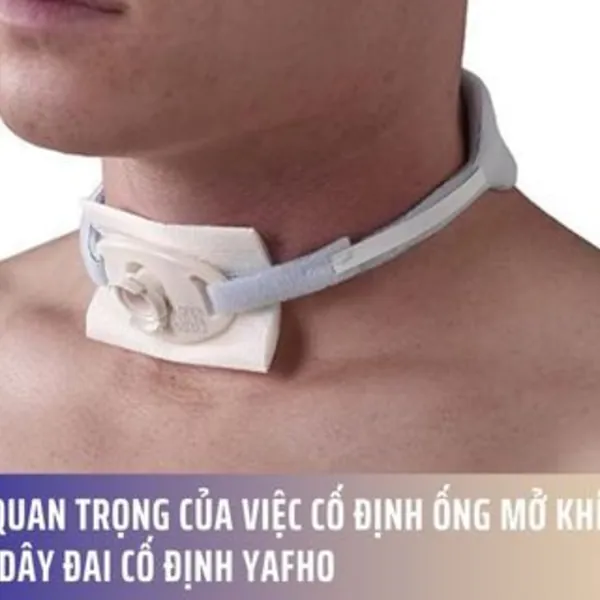 Tầm quan trọng của việc cố định ống mở khí quản cùng Dây đai cố định Yafho