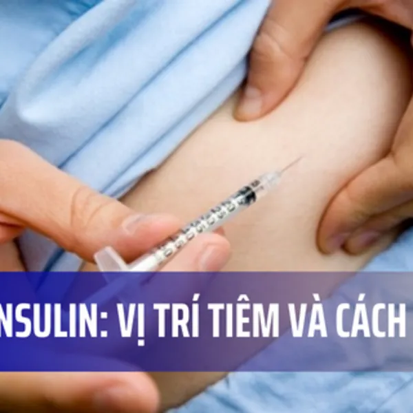 Tiêm insulin: Vị trí tiêm và cách tiêm