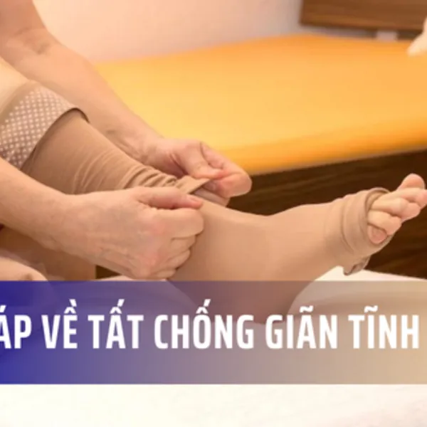 Hỏi đáp thường gặp về tất chống giãn tĩnh mạch