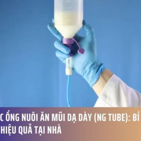 Chăm Sóc Ống Nuôi Ăn Mũi Dạ Dày (NG Tube): Bí Quyết An Toàn Và Hiệu Quả Tại Nhà