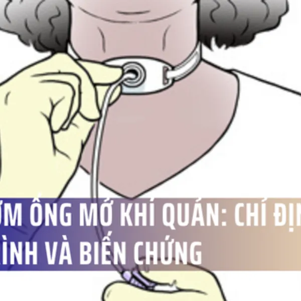 Hút đờm ống mở khí quản: Chỉ định, Quy trình và Biến chứng