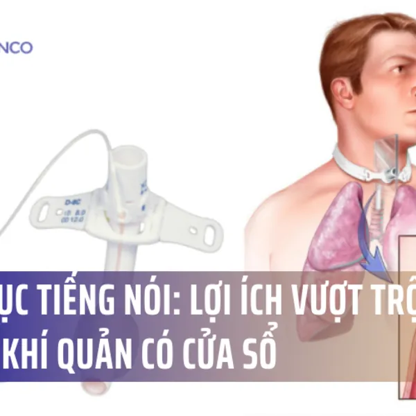 Khôi Phục Tiếng Nói: Lợi Ích Vượt Trội Của Ống Mở Khí Quản Có Cửa Sổ