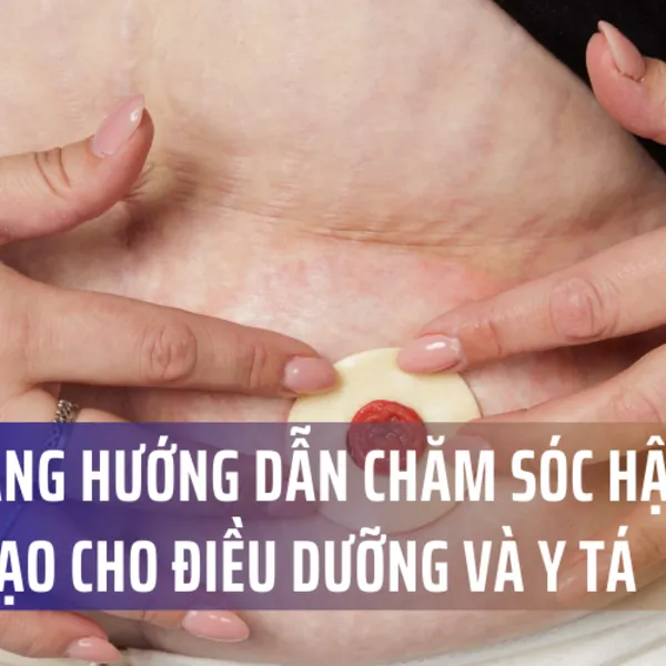 Cẩm nang hướng dẫn chăm sóc hậu môn nhân tạo cho điều dưỡng và y tá (Phần 3)