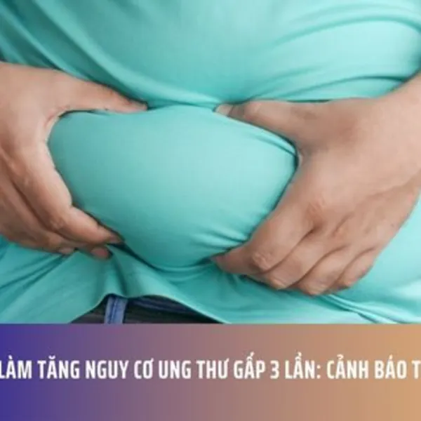 Béo Phì Làm Tăng Nguy Cơ Ung Thư Gấp 3 Lần: Cảnh Báo Từ Hoa Kỳ