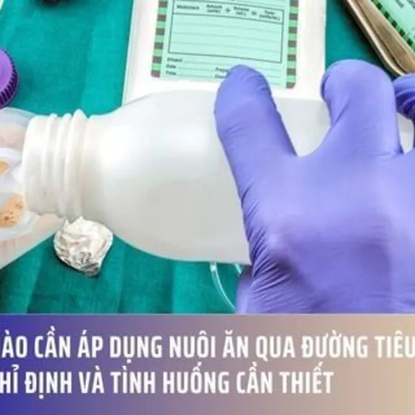 Khi nào cần áp dụng nuôi ăn qua đường tiêu hóa? Các chỉ định và tình huống cần thiết