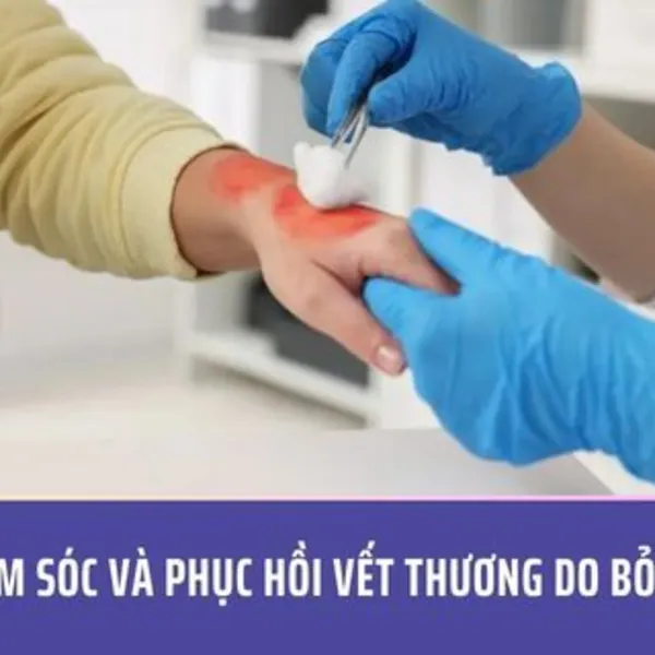 Chăm sóc và phục hồi vết thương do bỏng