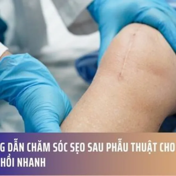 Hướng Dẫn Chăm Sóc Sẹo Sau Phẫu Thuật Cho Làn Da Phục Hồi Nhanh