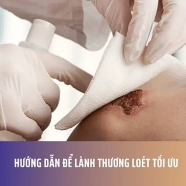 Hướng Dẫn Để Lành Thương Loét Tối Ưu