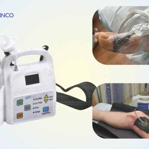 Đánh giá kết quả sử dụng phương pháp hút áp lực âm trong điều trị loét mạn tính