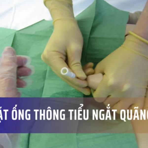 Hướng dẫn cách đặt ống thông tiểu ngắt quãng nam tại nhà
