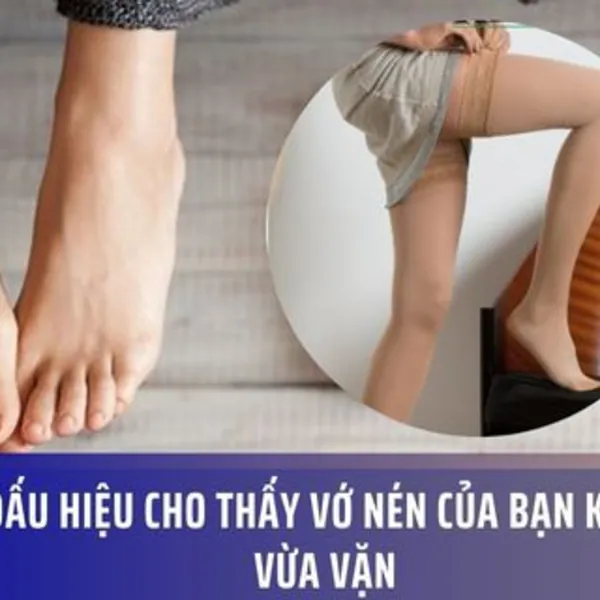 5 Dấu Hiệu Cho Thấy Vớ Nén Của Bạn Không Vừa Vặn